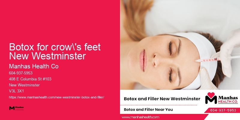 Botox injections for lines Botox for crow's feet New Westminster