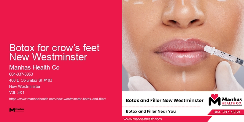 Botox promotions Botox for crow’s feet New Westminster