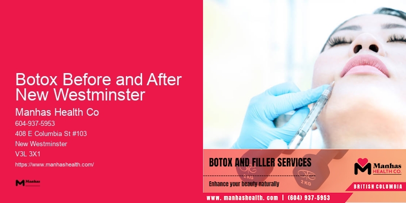 Non-surgical Facial Rejuvenation Botox Before and After New Westminster