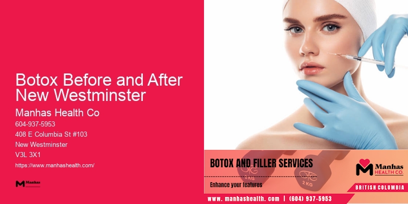 Affordable Botox Botox Before and After New Westminster
