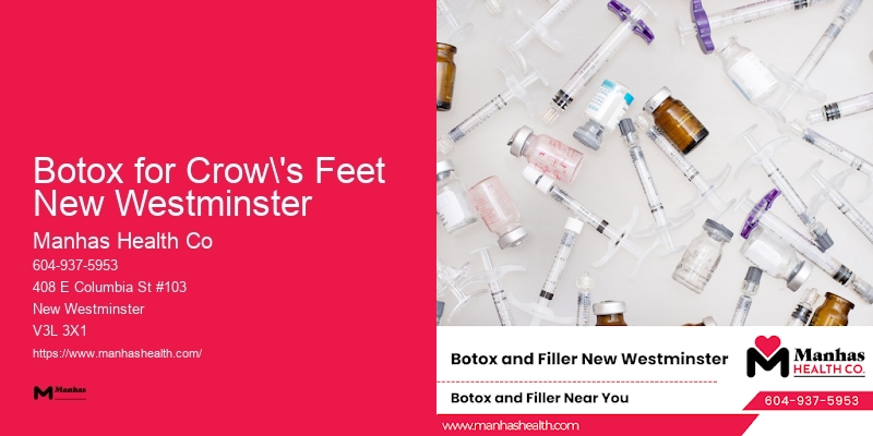 Beauty Injection Clinic Botox for Crow's Feet New Westminster