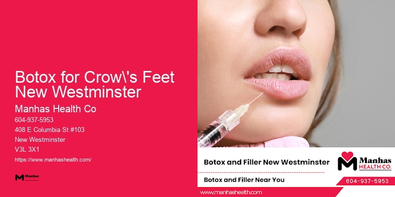Beauty Injection Services Botox for Crow's Feet New Westminster