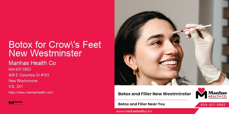 Botox for Crow's Feet New Westminster