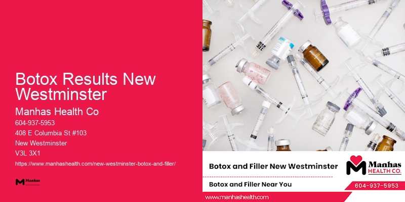 Botox facial treatments Botox Results New Westminster