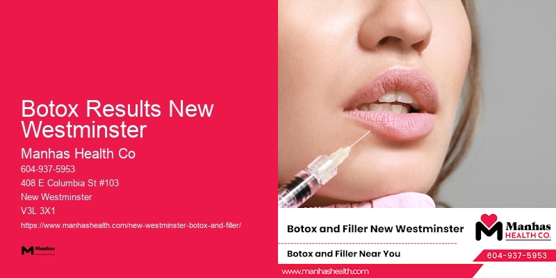 Botox for forehead creases Botox Results New Westminster