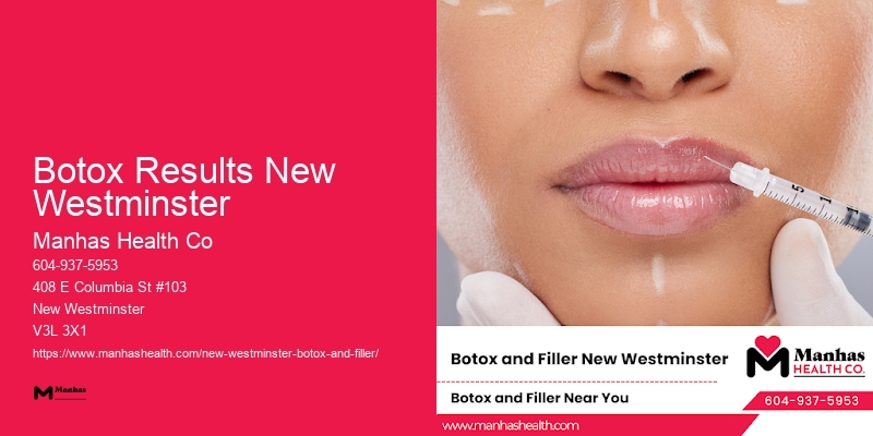 Best Botox packages Botox Results New Westminster