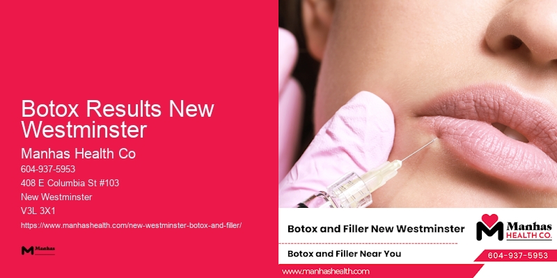 Botox for facial slimming Botox Results New Westminster