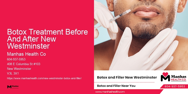 Botox for chin enhancement Botox Treatment Before And After New Westminster