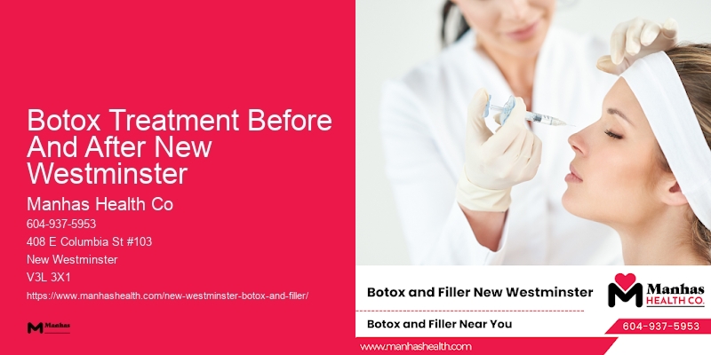 Botox to reduce forehead wrinkles Botox Treatment Before And After New Westminster