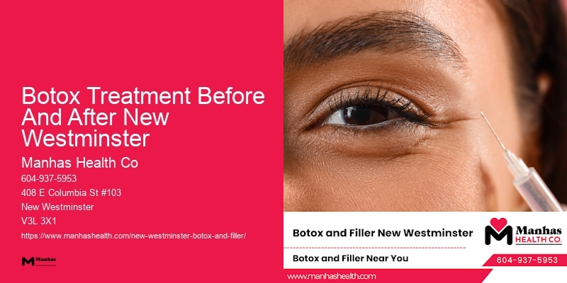 Long-lasting Botox results Botox Treatment Before And After New Westminster