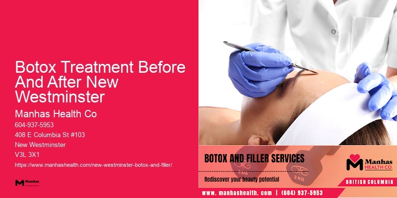Botox treatment process Botox Treatment Before And After New Westminster