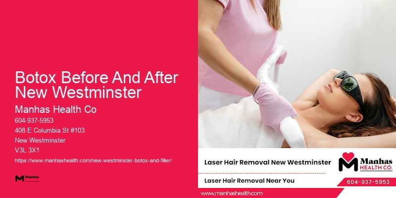 Botox And Skincare Botox Before And After New Westminster