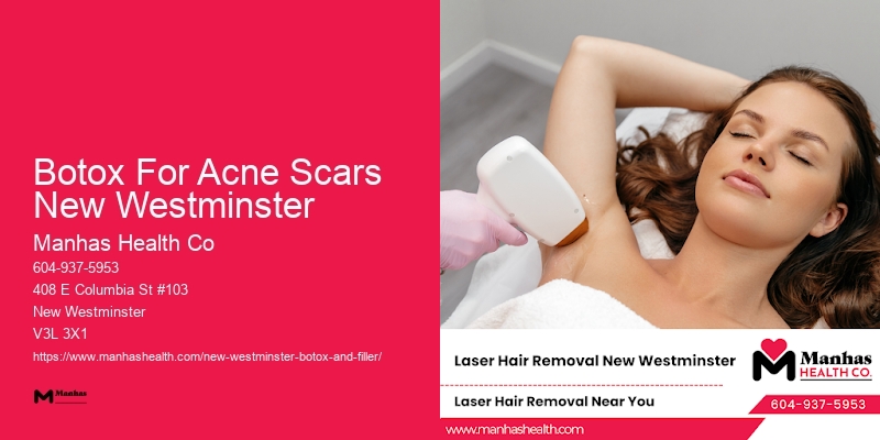 Botox Treatment Beauty Clinics Botox For Acne Scars New Westminster